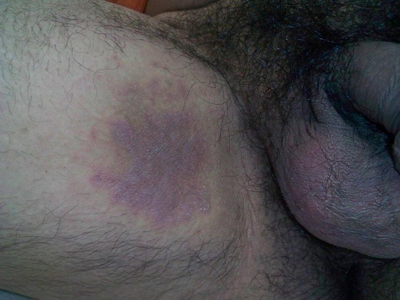 kvindens orgasmer hvornår kan en graviditet ses kvindens orgasmer hvornår kan en graviditet ses