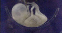 abortgrænse