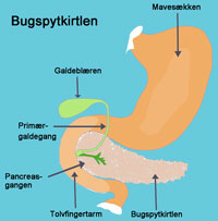 bugspytkirtelbetændelse