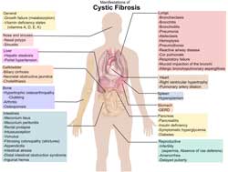 Cystisk fibrose
