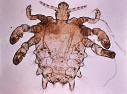 Fladlus
