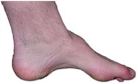 hulfod