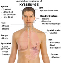 kyssesyge - symptomer