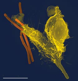 Leukocytter i urin