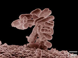 Her ses en virus der kan medføre madforgiftning