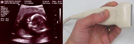 MD scanning