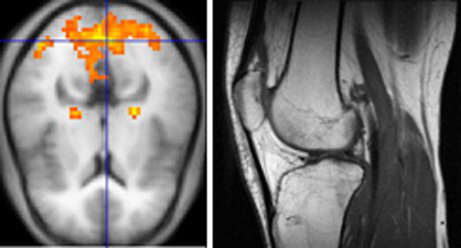 Mr Scanning Forlob Risici Hjerne Ryg Knae Hjerte M M