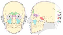 Pandehulebetændelse forekommer i sinus frontalis