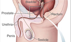 Symptomer på prostatakræft relaterer til urinrøret og blæren