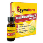 Molluscum Contagiosum Solution kan anvendes til behandling af vandvorter