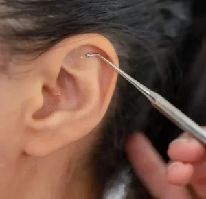 Ørefrø kan bruges mod stress, angst, uro, søvnproblemer, vægttab mm.